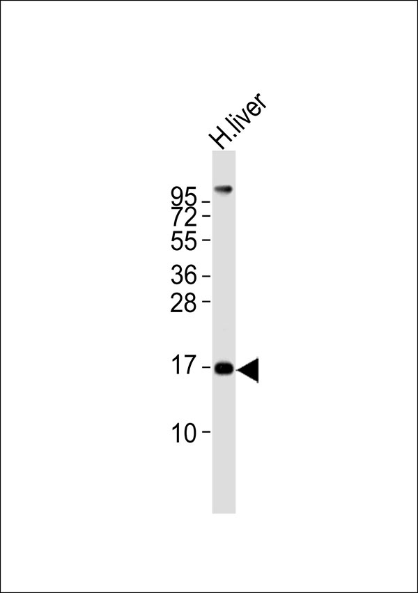 MGST2 Antibody - Anti-MGST2 Antibody at 1:1000 dilution + human liver lysates Lysates/proteins at 20 ug per lane. Secondary Goat Anti-Rabbit IgG, (H+L),Peroxidase conjugated at 1/10000 dilution Predicted band size : 17 kDa Blocking/Dilution buffer: 5% NFDM/TBST.