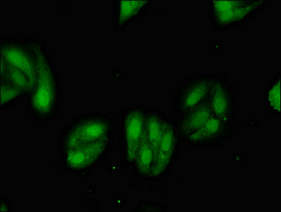 MGST2 Antibody - Immunofluorescent analysis of HepG2 cells diluted at 1:100 and Alexa Fluor 488-congugated AffiniPure Goat Anti-Rabbit IgG(H+L)