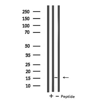 MGST2 Antibody - Western blot analysis of extracts of COLO205 cells using MGST2 antibody.