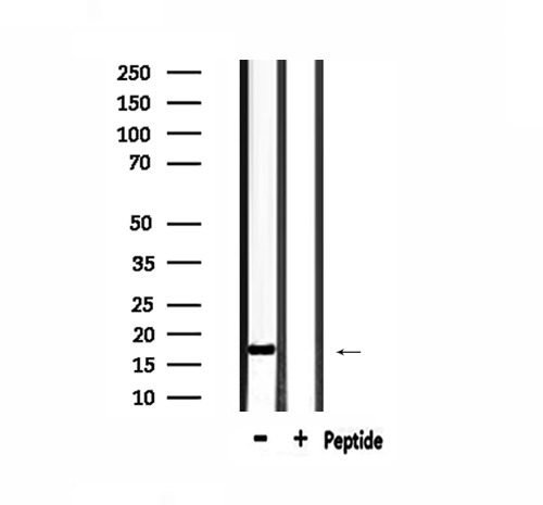 MGST2 Antibody - Western blot analysis of extracts of HepG2 cells using MGST2 antibody.