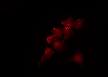 MGST2 Antibody - Staining COLO205 cells by IF/ICC. The samples were fixed with PFA and permeabilized in 0.1% Triton X-100, then blocked in 10% serum for 45 min at 25°C. The primary antibody was diluted at 1:200 and incubated with the sample for 1 hour at 37°C. An Alexa Fluor 594 conjugated goat anti-rabbit IgG (H+L) Ab, diluted at 1/600, was used as the secondary antibody.