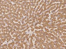 MGST2 Antibody - Immunochemical staining of human MGST2 in human liver with rabbit polyclonal antibody at 1:100 dilution, formalin-fixed paraffin embedded sections.