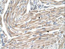 MGST2 Antibody - MGST2 antibody MGST2(microsomal glutathione S-transferase 2) Antibody was used in IHC to stain formalin-fixed, paraffin-embedded human muscle.  This image was taken for the unconjugated form of this product. Other forms have not been tested.