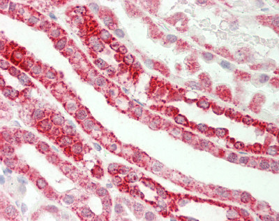MGST3 Antibody - Human Kidney: Formalin-Fixed, Paraffin-Embedded (FFPE).  This image was taken for the unconjugated form of this product. Other forms have not been tested.