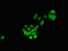 MGST3 Antibody - Immunofluorescent analysis of PC3 cells diluted at 1:100 and Alexa Fluor 488-congugated AffiniPure Goat Anti-Rabbit IgG(H+L)