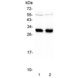 Mhc Class II Antigen (HLA-DRB1) Antibody - Western blot testing of two lots of human Raji lysate with HLA-DRB1 antibody at 0.5ug/ml. Predicted molecular weight ~30 kDa.