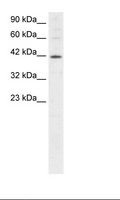 MI-ER1 / ER1 Antibody - HepG2 Cell Lysate.  This image was taken for the unconjugated form of this product. Other forms have not been tested.