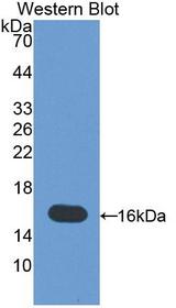 MIA / CD-RAP Antibody - Western blot of TANGO / MIA3 antibody.
