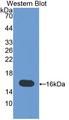 MIA / CD-RAP Antibody - Western blot of TANGO / MIA3 antibody.