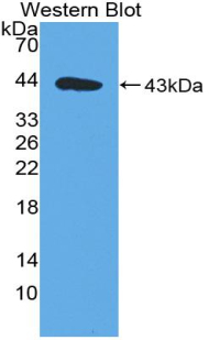 MIA / CD-RAP Antibody - Western blot of recombinant MIA.