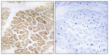 MIA / CD-RAP Antibody - Immunohistochemistry analysis of paraffin-embedded human heart tissue, using MIA Antibody. The picture on the right is blocked with the synthesized peptide.