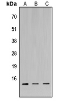MIA / CD-RAP Antibody - Western blot analysis of MIA1 expression in HeLa (A); Raw264.7 (B); H9C2 (C) whole cell lysates.