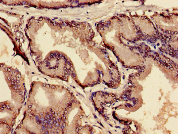 MIA / CD-RAP Antibody - Immunohistochemistry image of paraffin-embedded human prostate tissue at a dilution of 1:100