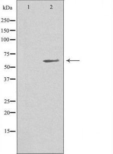 MIA2 Antibody - Western blot analysis of extracts of HuvEc cells using MIA2 antibody. The lane on the left is treated with the antigen-specific peptide.