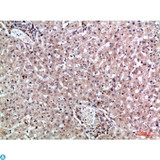 MIA2 Antibody - Immunohistochemical analysis of paraffin-embedded human-liver, antibody was diluted at 1:200.