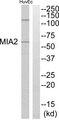 MIA2 Antibody - Western blot analysis of extracts from HuvEc cells, using MIA2 antibody.