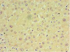 MIA40 / CHCHD4 Antibody - Immunohistochemistry of paraffin-embedded human liver tissue using antibody at 1:100 dilution.  This image was taken for the unconjugated form of this product. Other forms have not been tested.