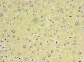 MIA40 / CHCHD4 Antibody - Immunohistochemistry of paraffin-embedded human liver tissue using antibody at 1:100 dilution.  This image was taken for the unconjugated form of this product. Other forms have not been tested.