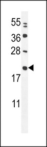 MIA40 / CHCHD4 Antibody - MIA40 Antibody western blot of MDA-MB231 cell line lysates (35 ug/lane). The MIA40 antibody detected the MIA40 protein (arrow).