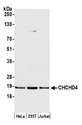 MIA40 / CHCHD4 Antibody - Detection of human CHCHD4 by western blot. Samples: Whole cell lysate (15 µg) from HeLa, HEK293T, and Jurkat cells prepared using NETN lysis buffer. Antibody: Affinity purified rabbit anti-CHCHD4 antibody used for WB at 1:1000. Detection: Chemiluminescence with an exposure time of 30 seconds.