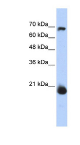 MIA40 / CHCHD4 Antibody - CHCHD4 / MIA40 antibody Western blot of Transfected 293T cell lysate. This image was taken for the unconjugated form of this product. Other forms have not been tested.
