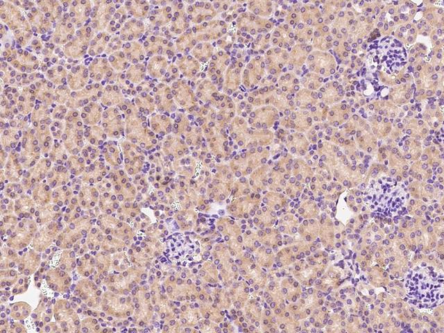 MIA40 / CHCHD4 Antibody - Immunochemical staining CHCHD4 in mouse kidney with rabbit polyclonal antibody at 1:1000 dilution, formalin-fixed paraffin embedded sections.