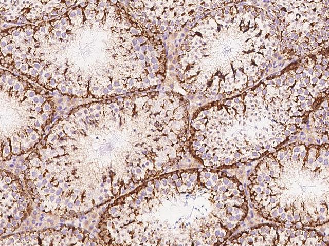 MIA40 / CHCHD4 Antibody - Immunochemical staining CHCHD4 in mouse testis with rabbit polyclonal antibody at 1:1000 dilution, formalin-fixed paraffin embedded sections.