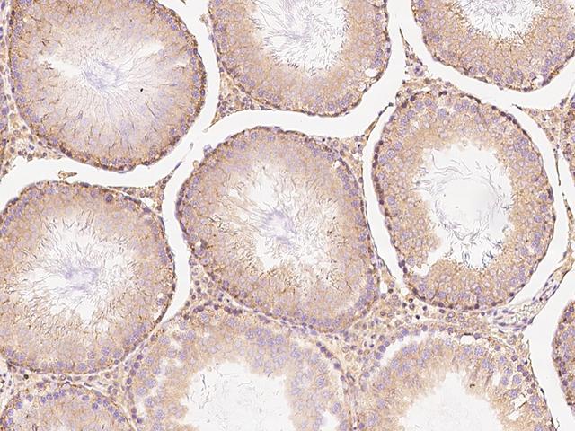 MIA40 / CHCHD4 Antibody - Immunochemical staining CHCHD4 in rat testis with rabbit polyclonal antibody at 1:1000 dilution, formalin-fixed paraffin embedded sections.