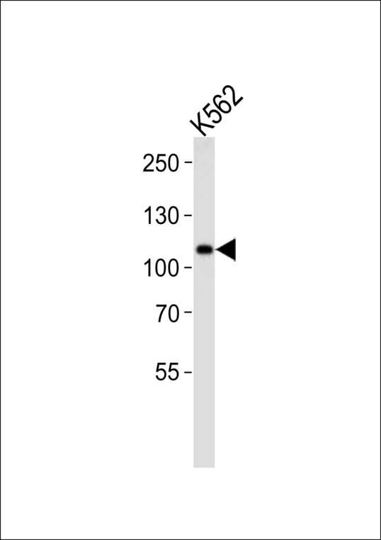 MIB1 Antibody - MIB Antibody (K28) western blot of K562 cell line lysates (35 ug/lane). The MIB antibody detected the MIB protein (arrow).
