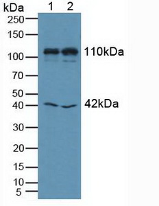 MIB1 Antibody - Western Blot; Lane1: Human K562 Cells; Lane2: Human Hela Cells.