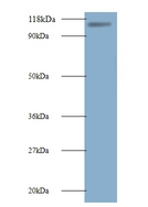 MIB1 Antibody - Western blot of HMGB1 antibody at 2ug/ml + 293T whole cell lysate. Secondary: Goat polyclonal to Rabbit IgG at 1:10000 dilution. Predicted band size: 111 kDa. Observed band size: 111 kDa.  This image was taken for the unconjugated form of this product. Other forms have not been tested.