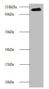 MIB1 Antibody - Western blot All lanes: E3 ubiquitin-protein ligase MIB1 antibody at 2µg/ml + 293T whole cell lysate Secondary Goat polyclonal to rabbit IgG at 1/10000 dilution Predicted band size: 111 kDa Observed band size: 111 kDa