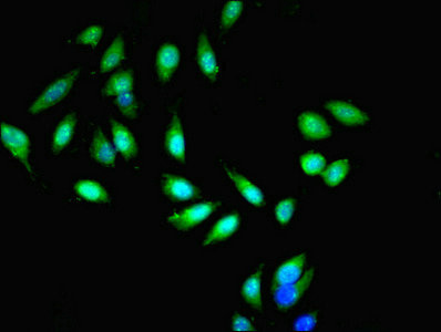 MIB1 Antibody - Immunofluorescent analysis of Hela cells using MIB1 Antibody at dilution of 1:100 and Alexa Fluor 488-congugated AffiniPure Goat Anti-Rabbit IgG(H+L)