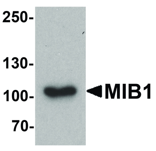 MIB1 Antibody - Western blot analysis of MIB1 in A431 cell lysate with MIB1 antibody at 1 ug/ml.