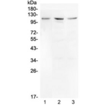 MIB1 Antibody - Western blot testing of human 1) U-87 MG, 2) HepG2 and 3) A375 cell lysate with Mib1 antibody at 0.5ug/ml. Predicted molecular weight ~110 kDa.