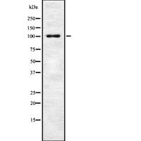 MIB1 Antibody - Western blot analysis of MIB1 using HeLa whole cells lysates