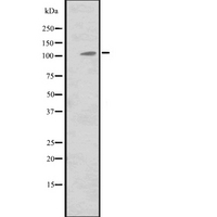 MIB2 Antibody - Western blot analysis of MIB2 expression in HeLa cells lysate. The lane on the left is treated with the antigen-specific peptide.