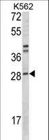 MIBP / ITGB1BP3 Antibody - Western blot of ITGB1BP3 Antibody in K562 cell line lysates (35 ug/lane). ITGB1BP3 (arrow) was detected using the purified antibody.