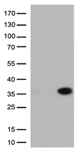 MIBP / ITGB1BP3 Antibody - HEK293T cells were transfected with the pCMV6-ENTRY control. (Left lane) or pCMV6-ENTRY ITGB1BP3. (Right lane) cDNA for 48 hrs and lysed. Equivalent amounts of cell lysates. (5 ug per lane) were separated by SDS-PAGE and immunoblotted with anti-ITGB1BP3. (1:2000)