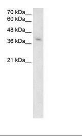 MICA Antibody - Jurkat Cell Lysate.  This image was taken for the unconjugated form of this product. Other forms have not been tested.