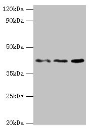 MICA Antibody - Western blot All lanes: MICA antibody at 8µg/ml Lane 1: MCF-7 whole cell lysate Lane 2: A431 whole cell lysate Lane 3: Mouse Stomach tissue Secondary Goat polyclonal to rabbit IgG at 1/10000 dilution Predicted band size: 43, 32 kDa Observed band size: 43 kDa