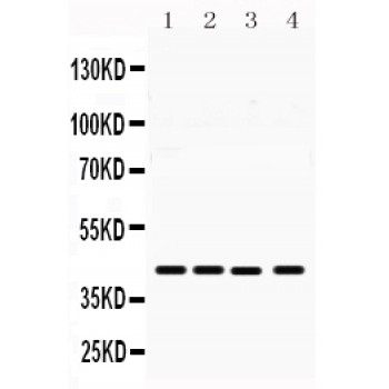 MICA Antibody - MICA antibody Western blot. All lanes: Anti MICA at 0.5 ug/ml. Lane 1: SW620Whole Cell Lysate at 40 ug. Lane 2: A549 Whole Cell Lysate at 40 ug. Lane 3: MCF-7 Whole Cell Lysate at 40 ug. Lane 4: HELA Whole Cell Lysate at 40 ug. Predicted band size: 43 kD. Observed band size: 43 kD.