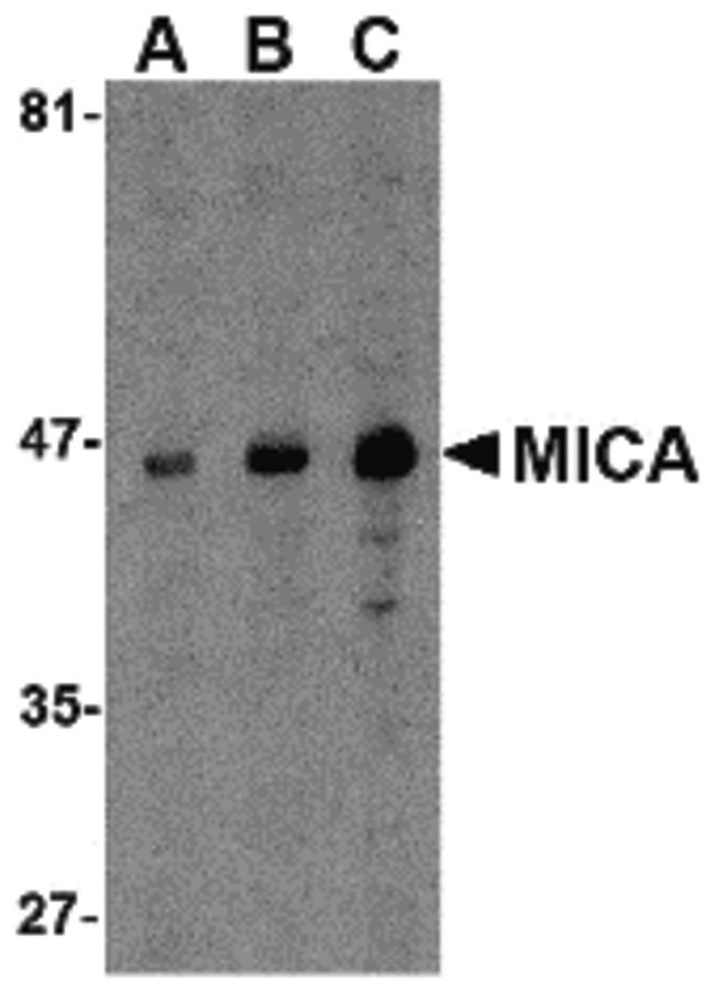 MICA Antibody - Western blot of MICA in A-20 cell lysate with MICA antibody at (A) 0.5, (B) 1 and (C) 2 ug/ml.