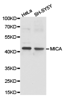 MICA Antibody - Western blot of extracts of various cell lines, using MICA antibody.