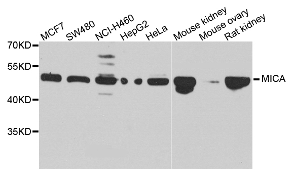 MICA Antibody - Western blot analysis of extracts of various cell lines, using MICA antibody at 1:1000 dilution. The secondary antibody used was an HRP Goat Anti-Rabbit IgG (H+L) at 1:10000 dilution. Lysates were loaded 25ug per lane and 3% nonfat dry milk in TBST was used for blocking. An ECL Kit was used for detection and the exposure time was 90s.