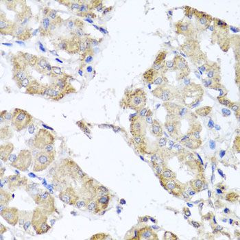 MICA Antibody - Immunohistochemistry of paraffin-embedded human stomach using MICA antibody at dilution of 1:100 (40x lens).
