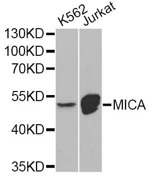MICA Antibody - Western blot analysis of extracts of various cell lines, using MICA Antibody at 1:1000 dilution. The secondary antibody used was an HRP Goat Anti-Rabbit IgG (H+L) at 1:10000 dilution. Lysates were loaded 25ug per lane and 3% nonfat dry milk in TBST was used for blocking.