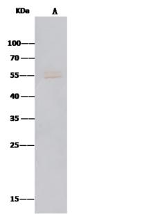 MICA Antibody - MICA was immunoprecipitated using: Lane A: 0.5 mg A431 Whole Cell Lysate. 2 uL anti-MICA rabbit polyclonal antibody and 15 ul of 50% Protein G agarose. Primary antibody: Anti-MICA rabbit polyclonal antibody, at 1:100 dilution. Secondary antibody: Clean-Blot IP Detection Reagent (HRP) at 1:500 dilution. Developed using the DAB staining technique. Performed under reducing conditions. Predicted band size: 55 kDa. Observed band size: 55 kDa.