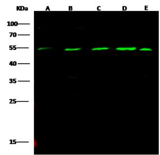 MICA Antibody - Anti-MICA rabbit polyclonal antibody at 1:500 dilution. Lane A: 293T Whole Cell Lysate. Lane B: Jurkat Whole Cell Lysate. Lane C: Daudi Whole Cell Lysate. Lysates/proteins at 30 ug per lane. Secondary: Goat Anti-Rabbit IgG H&L (Dylight800) at 1/10000 dilution. Developed using the Odyssey technique. Performed under reducing conditions. Predicted band size: 43 kDa. Observed band size: 55 kDa.