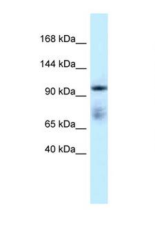 MICAL1 / MICAL Antibody - MICAL1 antibody Western blot of Placenta lysate. Antibody concentration 1 ug/ml.  This image was taken for the unconjugated form of this product. Other forms have not been tested.